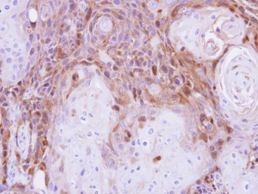 Peripherin Antibody in Immunohistochemistry (Paraffin) (IHC (P))