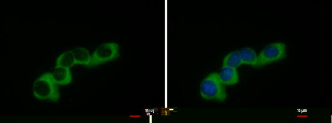 COL1A2 Antibody in Immunocytochemistry (ICC/IF)