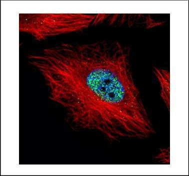 Cyclin E Antibody in Immunocytochemistry (ICC/IF)