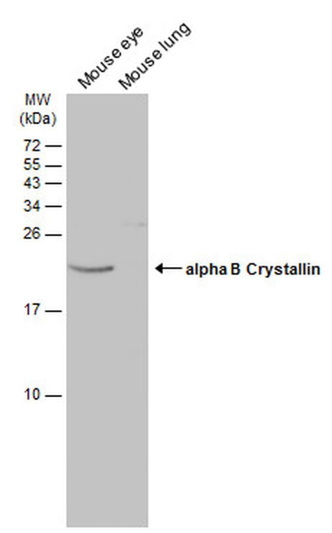 CRYAB Antibody in Western Blot (WB)