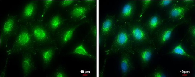 LAMP2 Antibody in Immunocytochemistry (ICC/IF)