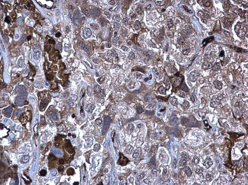 MMP10 Antibody in Immunohistochemistry (Paraffin) (IHC (P))