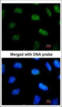 STAT3 Antibody in Immunocytochemistry (ICC/IF)