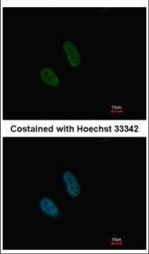 ATRIP Antibody in Immunocytochemistry (ICC/IF)