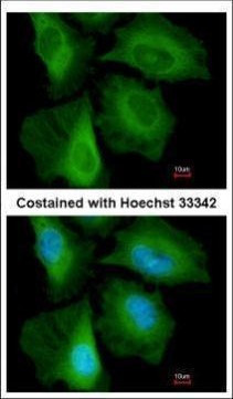 Calcyclin Antibody in Immunocytochemistry (ICC/IF)