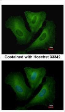 HLA-DRB3 Antibody in Immunocytochemistry (ICC/IF)