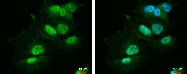 PBX1 Antibody in Immunocytochemistry (ICC/IF)
