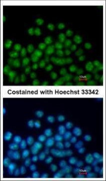 Nkx2.5 Antibody in Immunocytochemistry (ICC/IF)