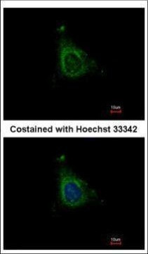 AKAP10 Antibody in Immunocytochemistry (ICC/IF)