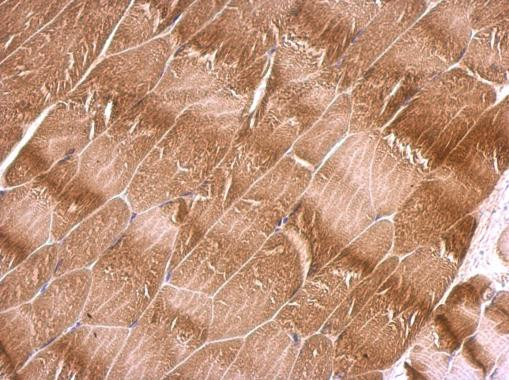 NEGR1 Antibody in Immunohistochemistry (Paraffin) (IHC (P))