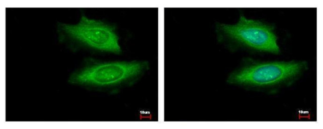 VCPIP1 Antibody in Immunocytochemistry (ICC/IF)