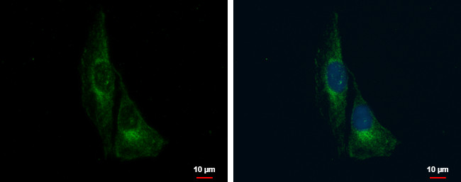 TrkC Antibody in Immunocytochemistry (ICC/IF)
