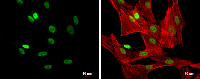 FOXP3 Antibody in Immunocytochemistry (ICC/IF)