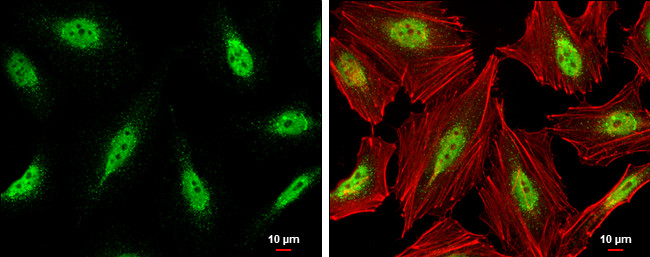 CDK9 Antibody in Immunocytochemistry (ICC/IF)