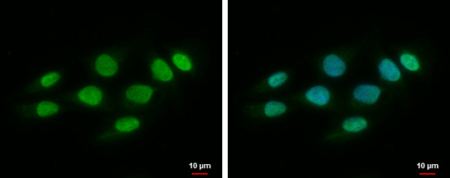 SPHK1 Antibody in Immunocytochemistry (ICC/IF)