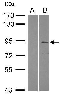 TRIM2 Antibody in Western Blot (WB)
