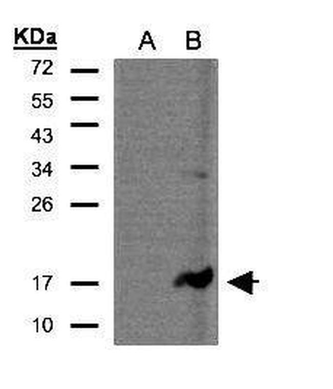 CD3z Antibody in Western Blot (WB)