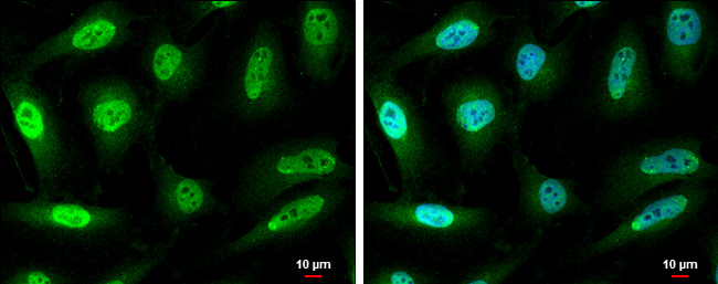 SMAD3 Antibody in Immunocytochemistry (ICC/IF)