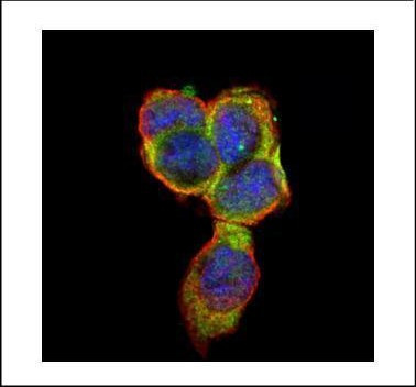 CEA Antibody in Immunocytochemistry (ICC/IF)