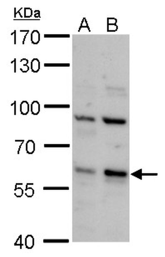 PCTAIRE2 Antibody in Western Blot (WB)