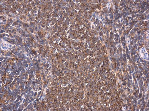 PKC theta Antibody in Immunohistochemistry (Paraffin) (IHC (P))