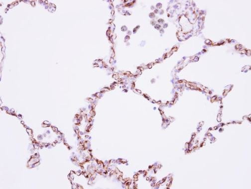 CDH11 Antibody in Immunohistochemistry (Paraffin) (IHC (P))