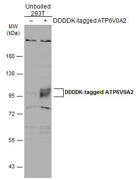 ATP6V0A2 Antibody in Western Blot (WB)