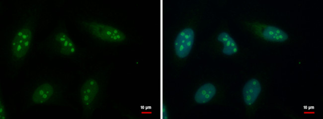 GTPBP4 Antibody in Immunocytochemistry (ICC/IF)