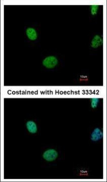 ATM Antibody in Immunocytochemistry (ICC/IF)