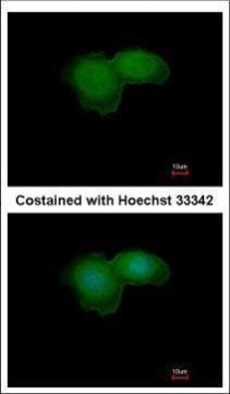 BTK Antibody in Immunocytochemistry (ICC/IF)