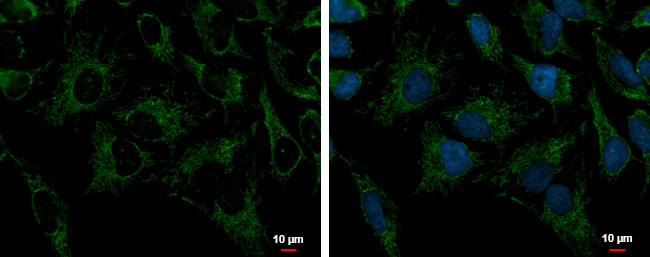 PRDX3 Antibody in Immunocytochemistry (ICC/IF)