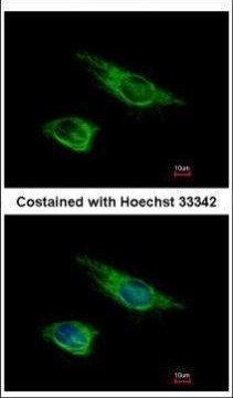 Vimentin Antibody in Immunocytochemistry (ICC/IF)