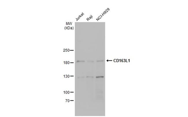CD163L1 Antibody in Western Blot (WB)