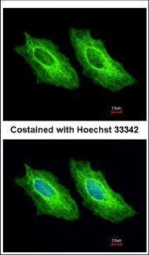 Cytokeratin 18 Antibody in Immunocytochemistry (ICC/IF)