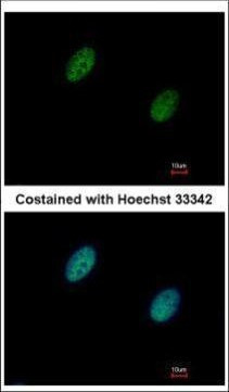 CHK2 Antibody in Immunocytochemistry (ICC/IF)