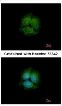 LRRK2 Antibody in Immunocytochemistry (ICC/IF)