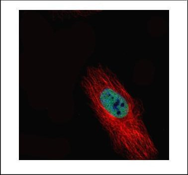 HDAC2 Antibody in Immunocytochemistry (ICC/IF)