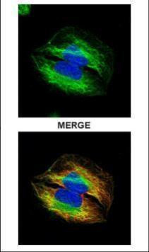 TUBA4A Antibody in Immunocytochemistry (ICC/IF)