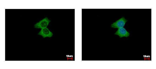 alpha Actinin 4 Antibody in Immunocytochemistry (ICC/IF)