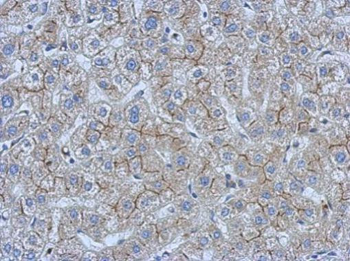 CEA Antibody in Immunohistochemistry (Paraffin) (IHC (P))
