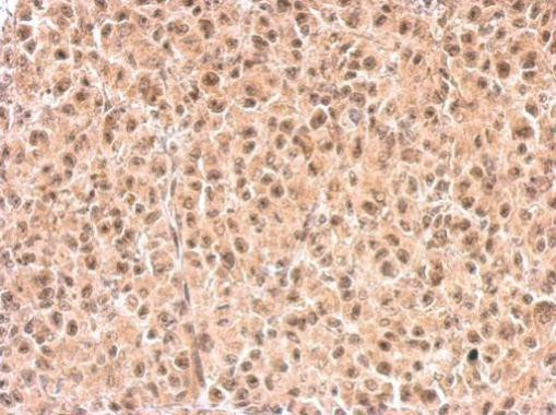 RXRB Antibody in Immunohistochemistry (Paraffin) (IHC (P))