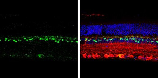 CHX10 Antibody in Immunohistochemistry (Paraffin) (IHC (P))