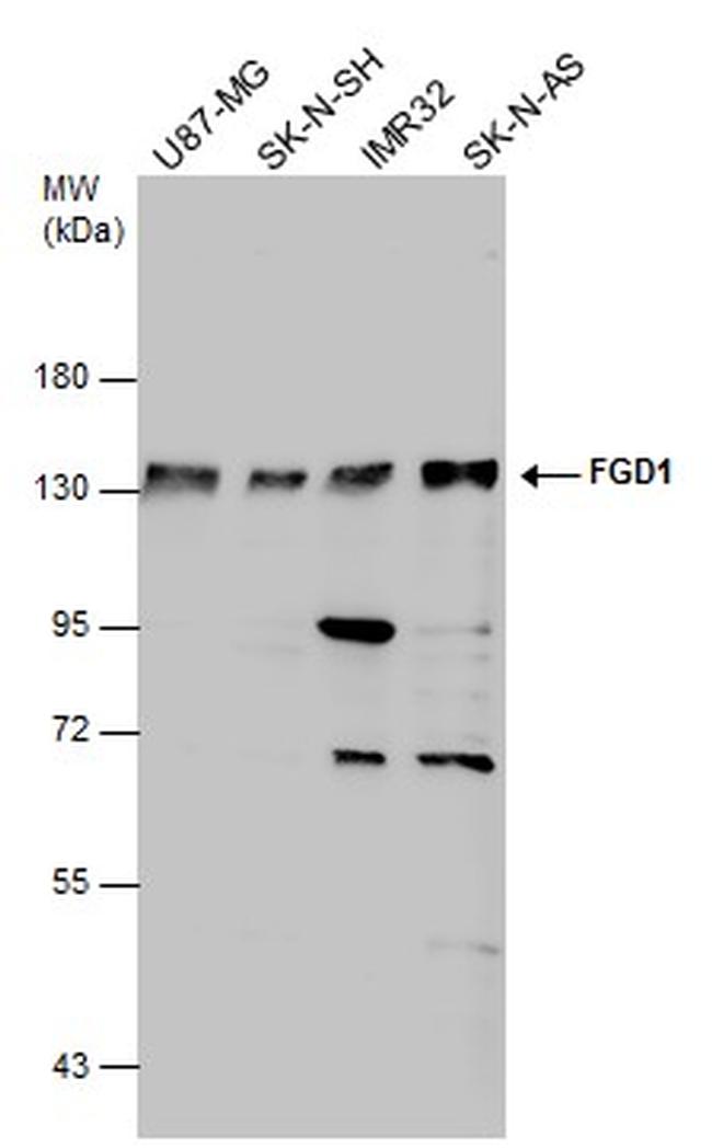 FGD1 Antibody in Western Blot (WB)