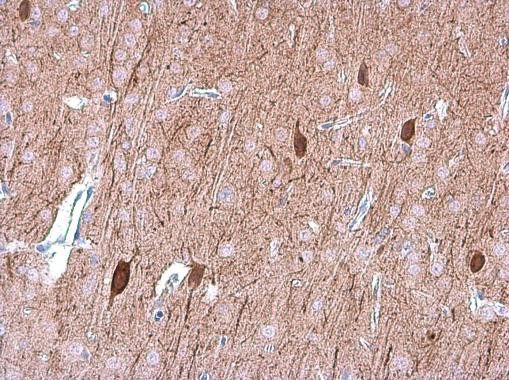 OMG Antibody in Immunohistochemistry (Paraffin) (IHC (P))