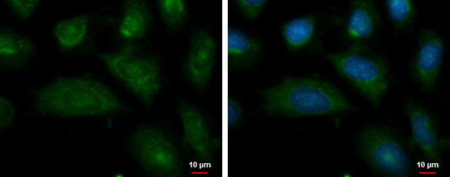 ENPP2 Antibody in Immunocytochemistry (ICC/IF)