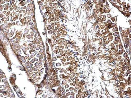 SH3GL3 Antibody in Immunohistochemistry (Paraffin) (IHC (P))