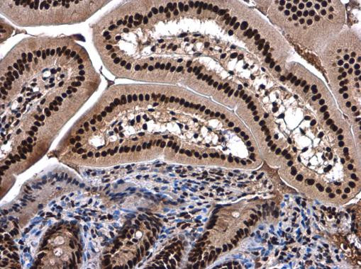 SMARCC2 Antibody in Immunohistochemistry (Paraffin) (IHC (P))