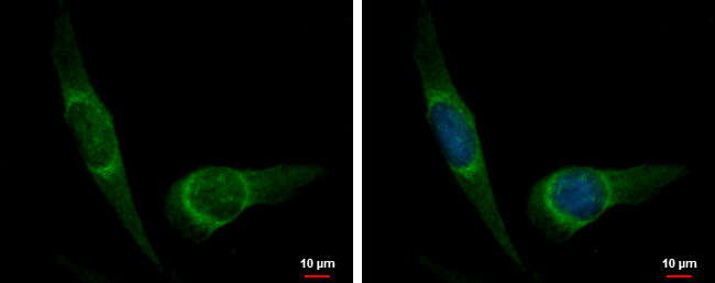 DUSP8 Antibody in Immunocytochemistry (ICC/IF)