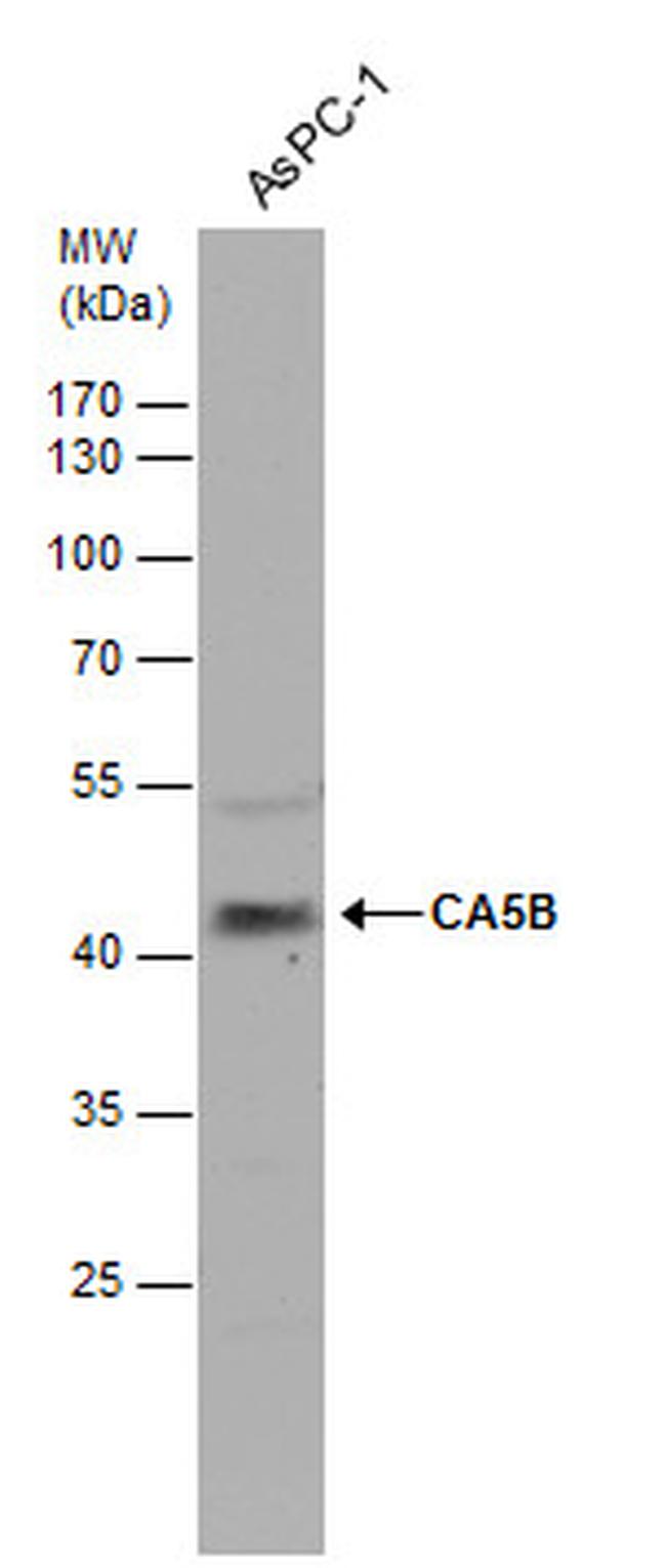 Carbonic Anhydrase VB Antibody in Western Blot (WB)