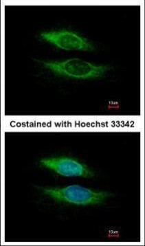 Nicastrin Antibody in Immunocytochemistry (ICC/IF)